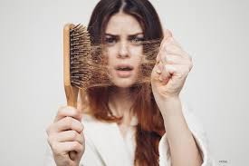 The Ultimate Guide to Hair Loss Solutions for Women: Regain Your Confidence Today
