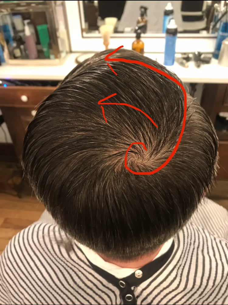 What Are Cowlicks and Why Do They Make Hair Styling Difficult?